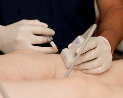 Ultrasound-guided stem cell, exosome, and PRP joint injections at Vella Method